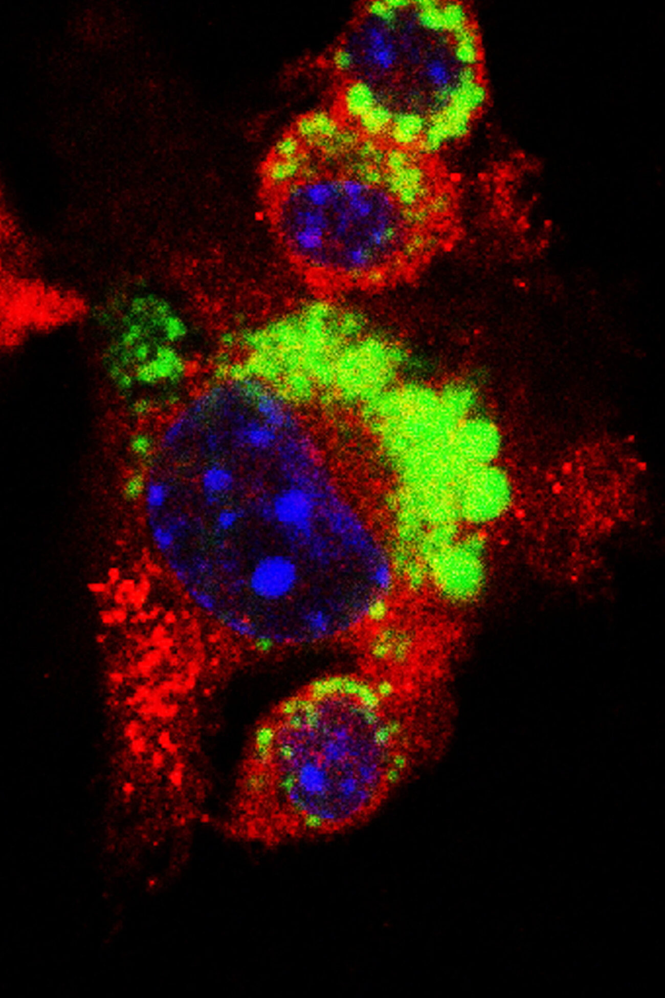 Nanoplastics Are All Around (and Inside) Us – State of the Planet